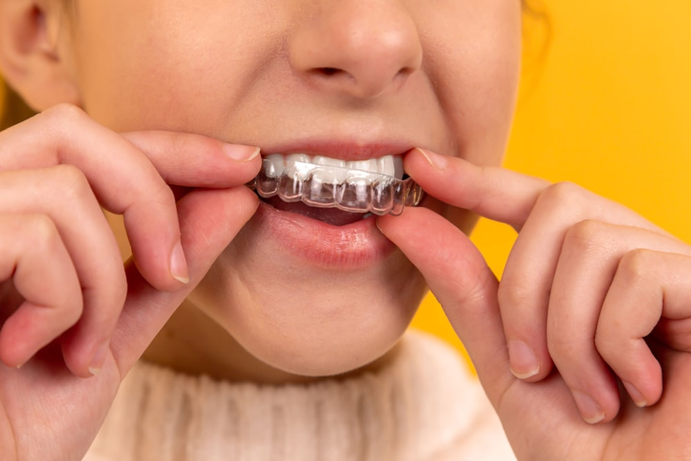 An image of a person removing clear aligners