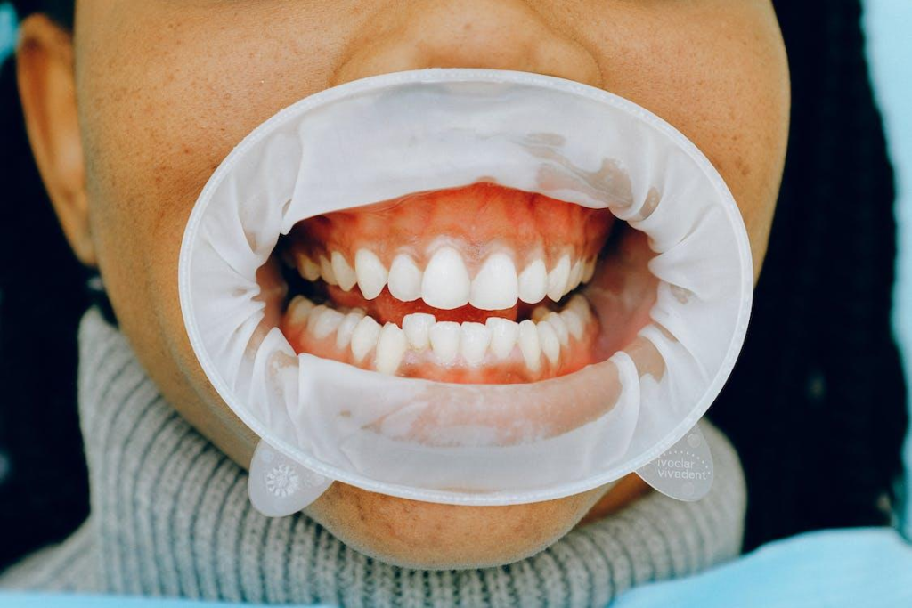 Preventing Dental Emergencies